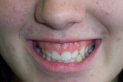 2-jade-e1537319607719
