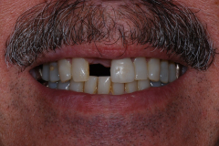 mwd55778