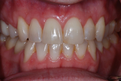 2_-1