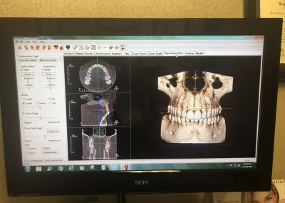 Route-66-Implants_-Technology